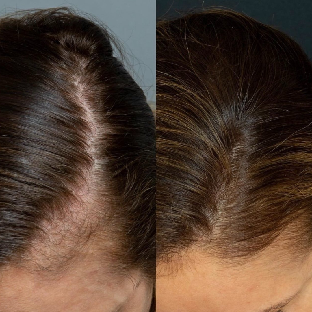 The Muse Labs Peptide Hair Growth Serum | Multi-Peptide Complex with Copper Peptides | Boosts Hair Growth, Reduces Hair Fall & Strengthens Roots