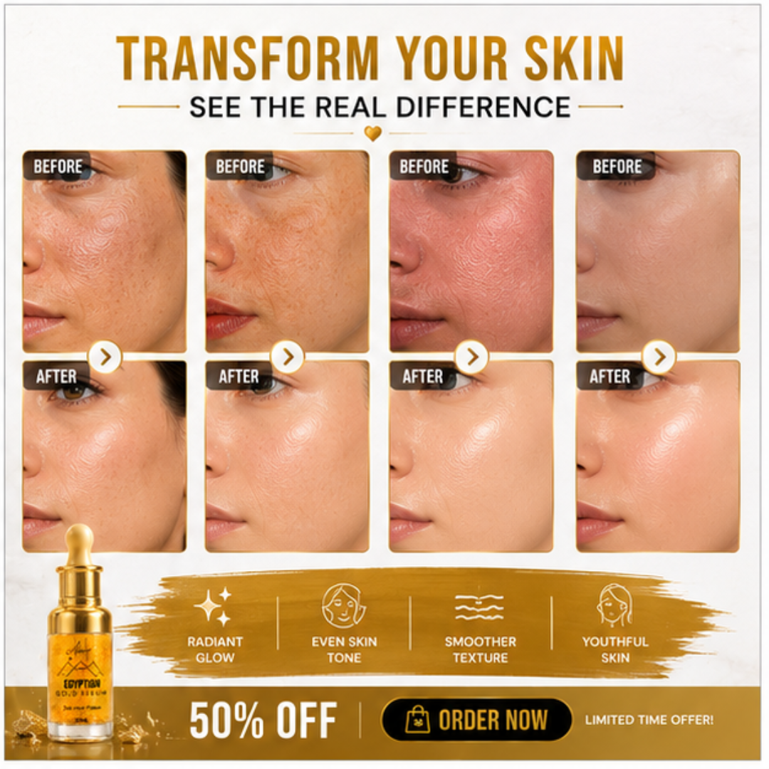 Amor Egyptian Gold Serum – 50% OFF – 24K Gold Flakes – Glow, Radiance & Luxury – Brightens Skin, Deep Hydration, Youthful Radiance – Reduces Fine Lines & Wrinkles – For All Skin Types – 30ml