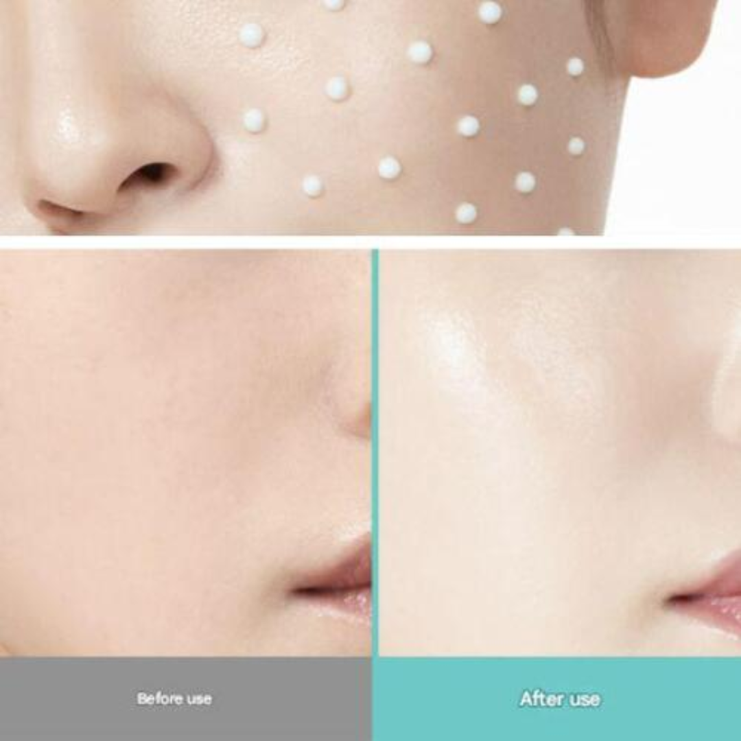 Anua PDRN + Hyaluronic Acid 100 Moisturizing Cream – Deep Hydration & Skin Plumping Cream for Glass Skin