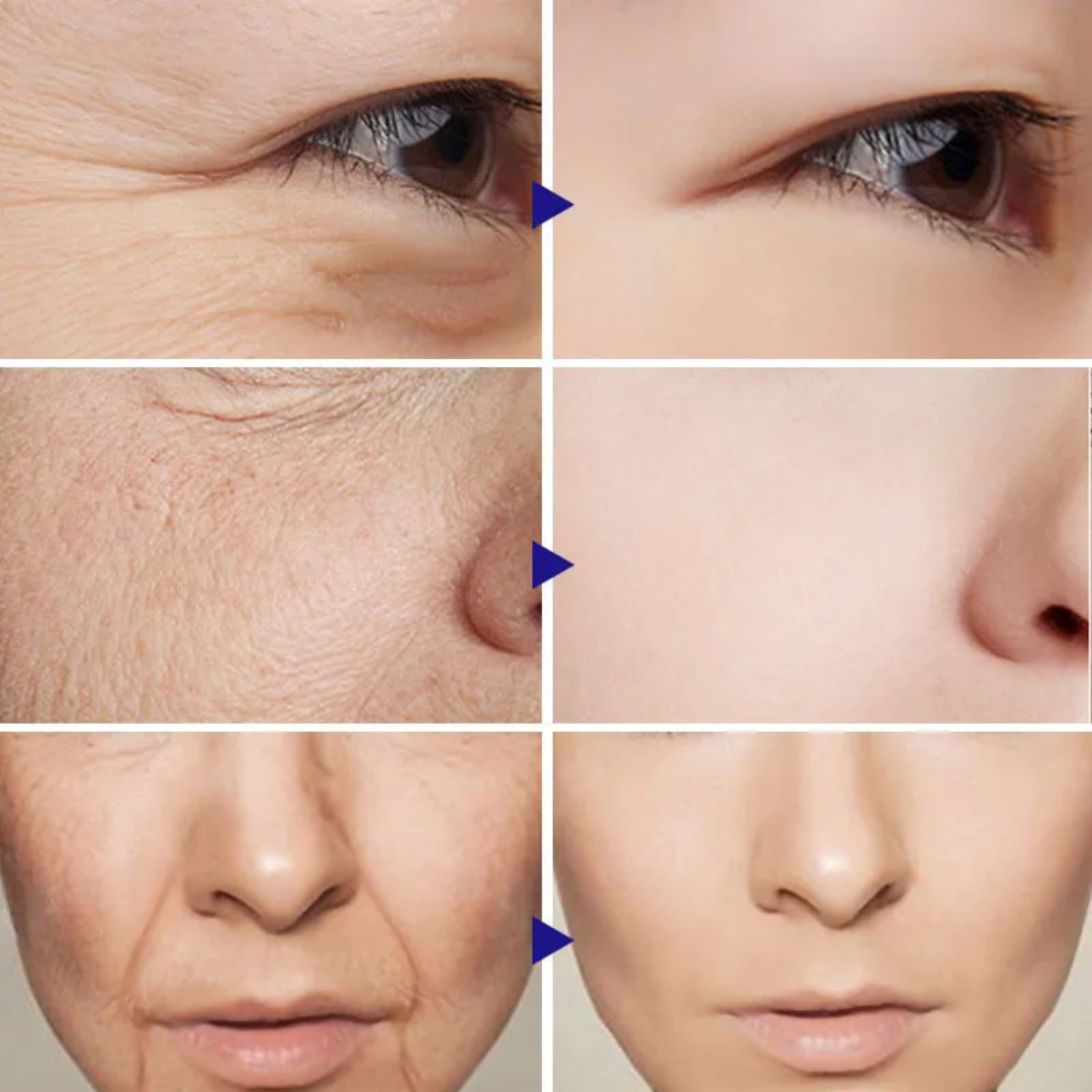 Anti-Wrinkle Firming Cream – Retinol + Peptides + Hyaluronic Acid – Reduces Fine Lines & Wrinkles, Firms & Lifts Skin, Boosts Collagen – For Eyes & Face