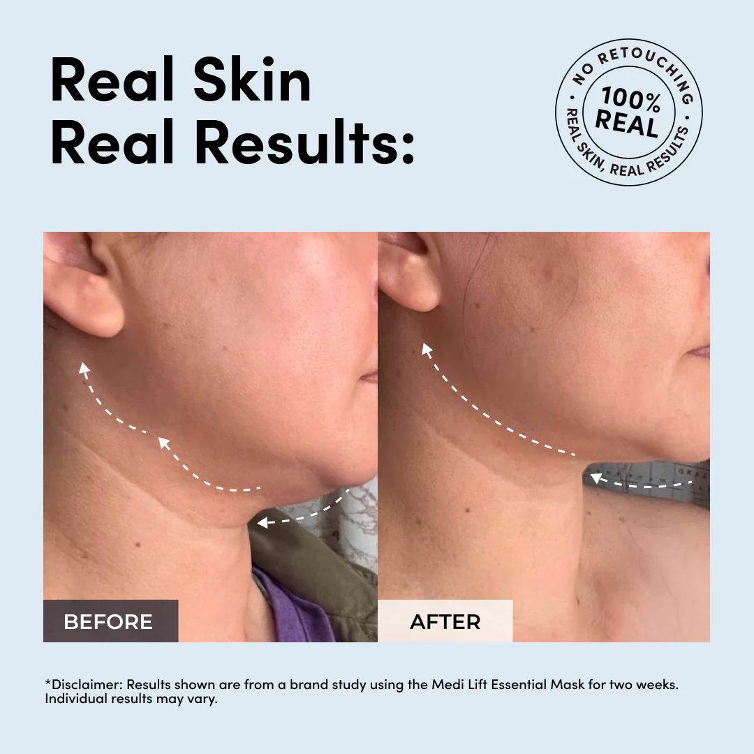 3D Lifting Full Face Tension Gel Mask | Instant Face Lifting Mask with High-Elastic Thread Technology | Sculpts, Lifts, Firms in 30 Minutes