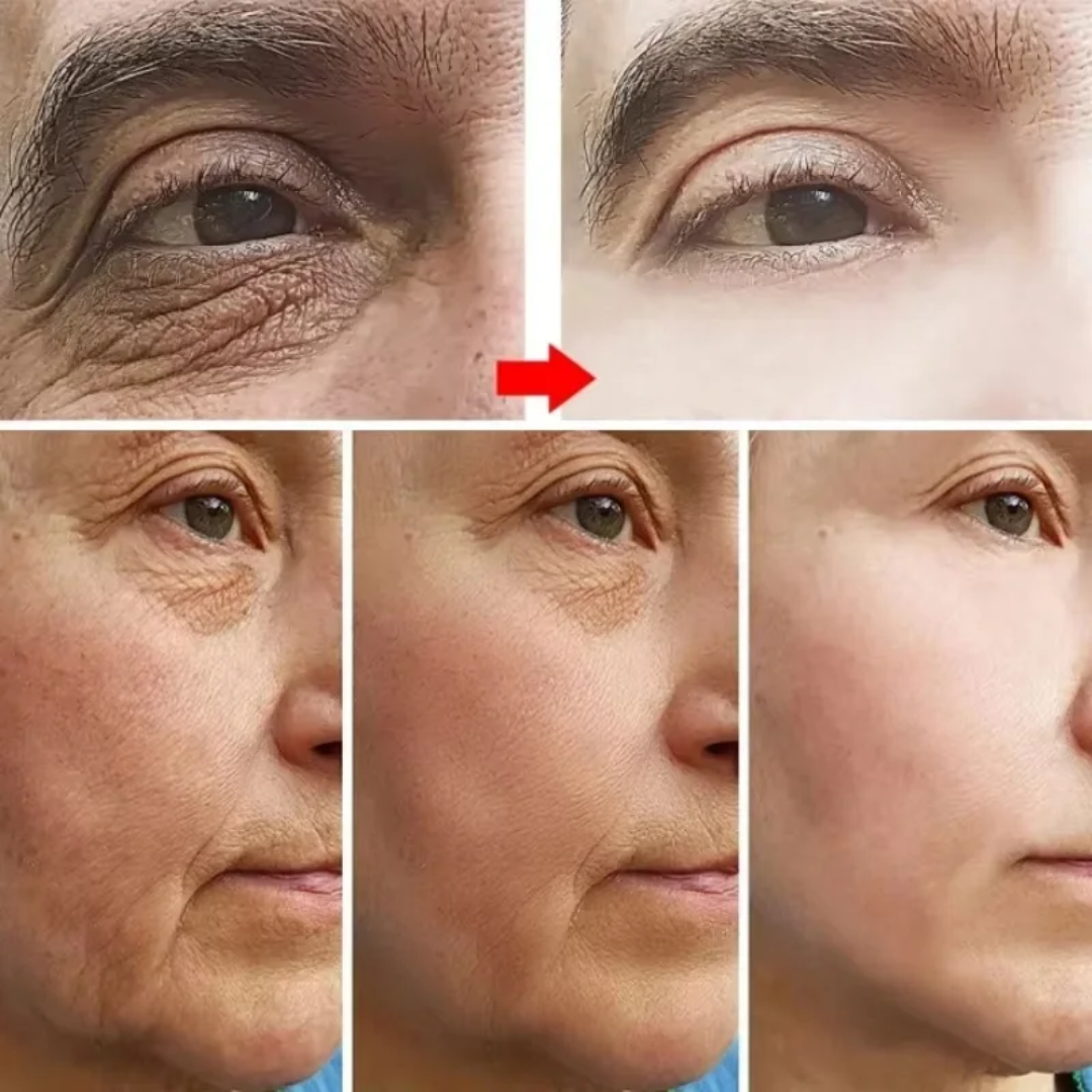 Anti-Wrinkle Firming Cream – Retinol + Peptides + Hyaluronic Acid – Reduces Fine Lines & Wrinkles, Firms & Lifts Skin, Boosts Collagen – For Eyes & Face