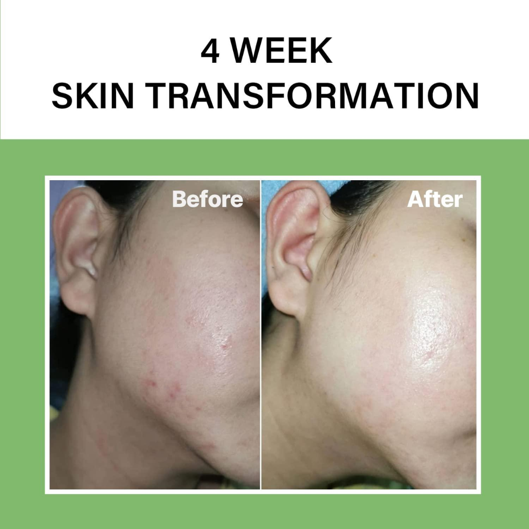 Celimax Noni Ampoule Calming + Radiance | Soothing Hydrating Serum for Healthy, Glowing Skin