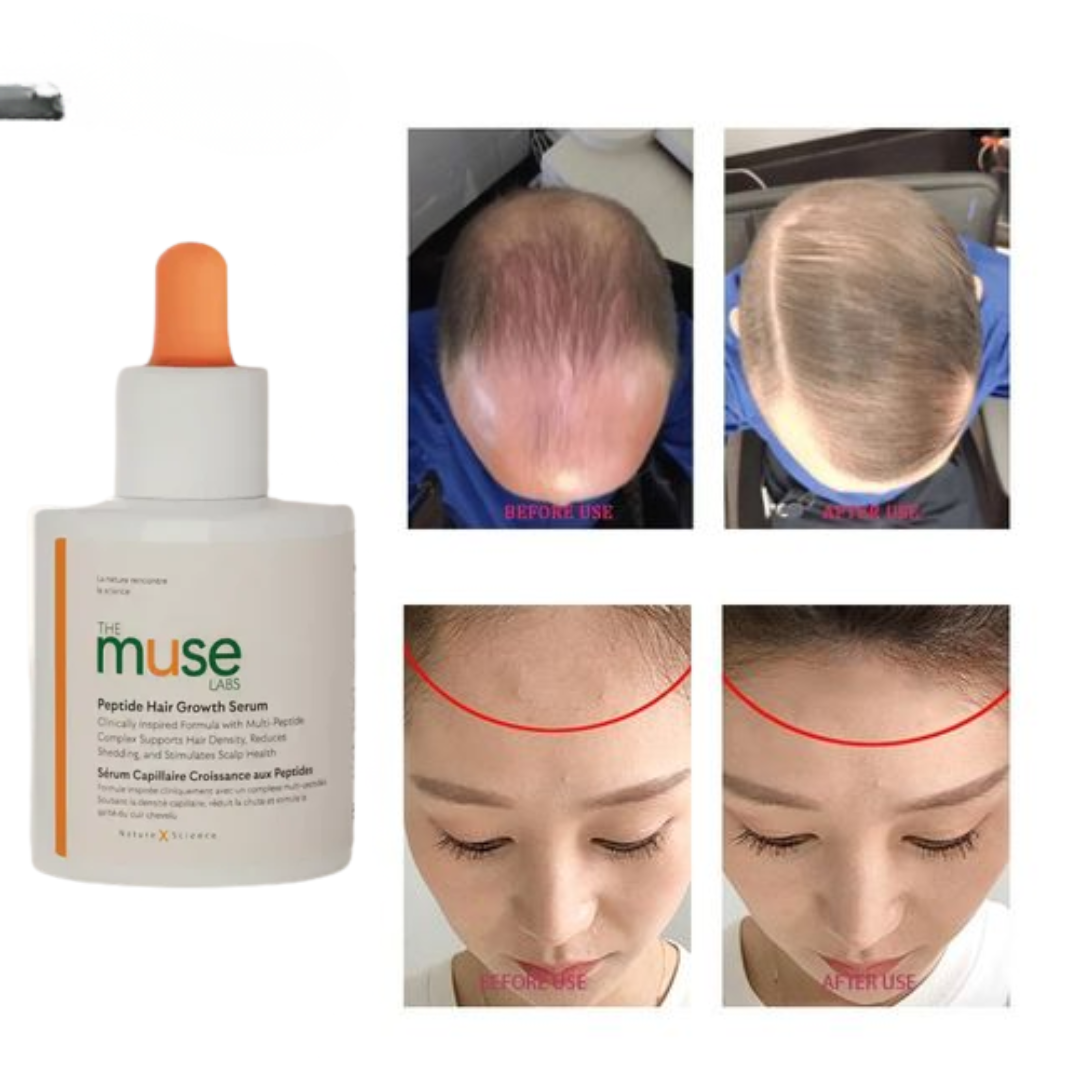 The Muse Labs Peptide Hair Growth Serum | Reduces Hair Fall, Boosts Density & Strengthens Roots | Multi-Peptide Formula