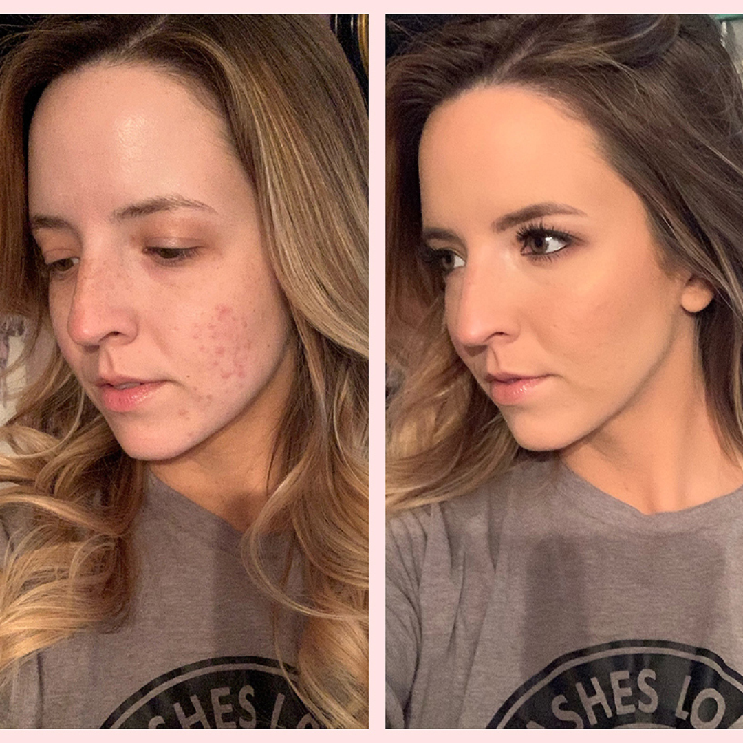 SL Basics No Makeup Deal – Flawless Skin, Natural Glow Every Day – Complete 4-Piece Set: BB Block SPF 50+, Rose & Honey Toner Mist, Gold & Pearl Serum, PinaPop Lip & Cheek Tint