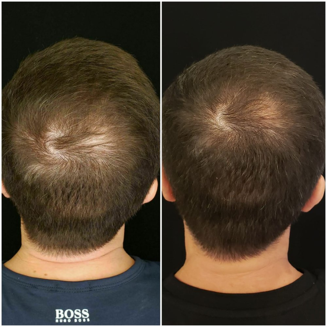 The Muse Labs Peptide Hair Growth Serum | Multi-Peptide Complex with Copper Peptides | Boosts Hair Growth, Reduces Hair Fall & Strengthens Roots