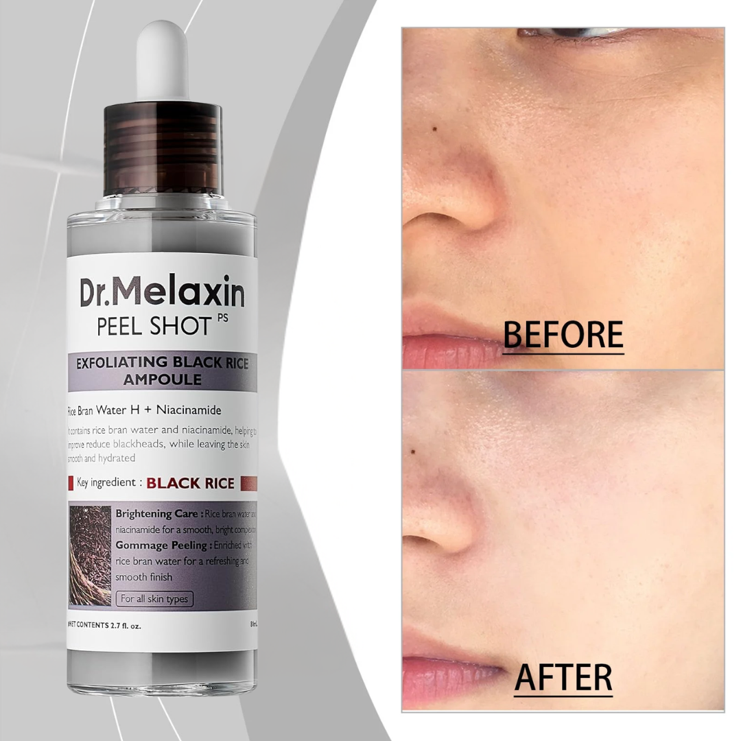 Dr. Melaxin Peel Shot PS Exfoliating Black Rice Ampoule | Removes Blackheads, Tightens Pores & Smooths Skin