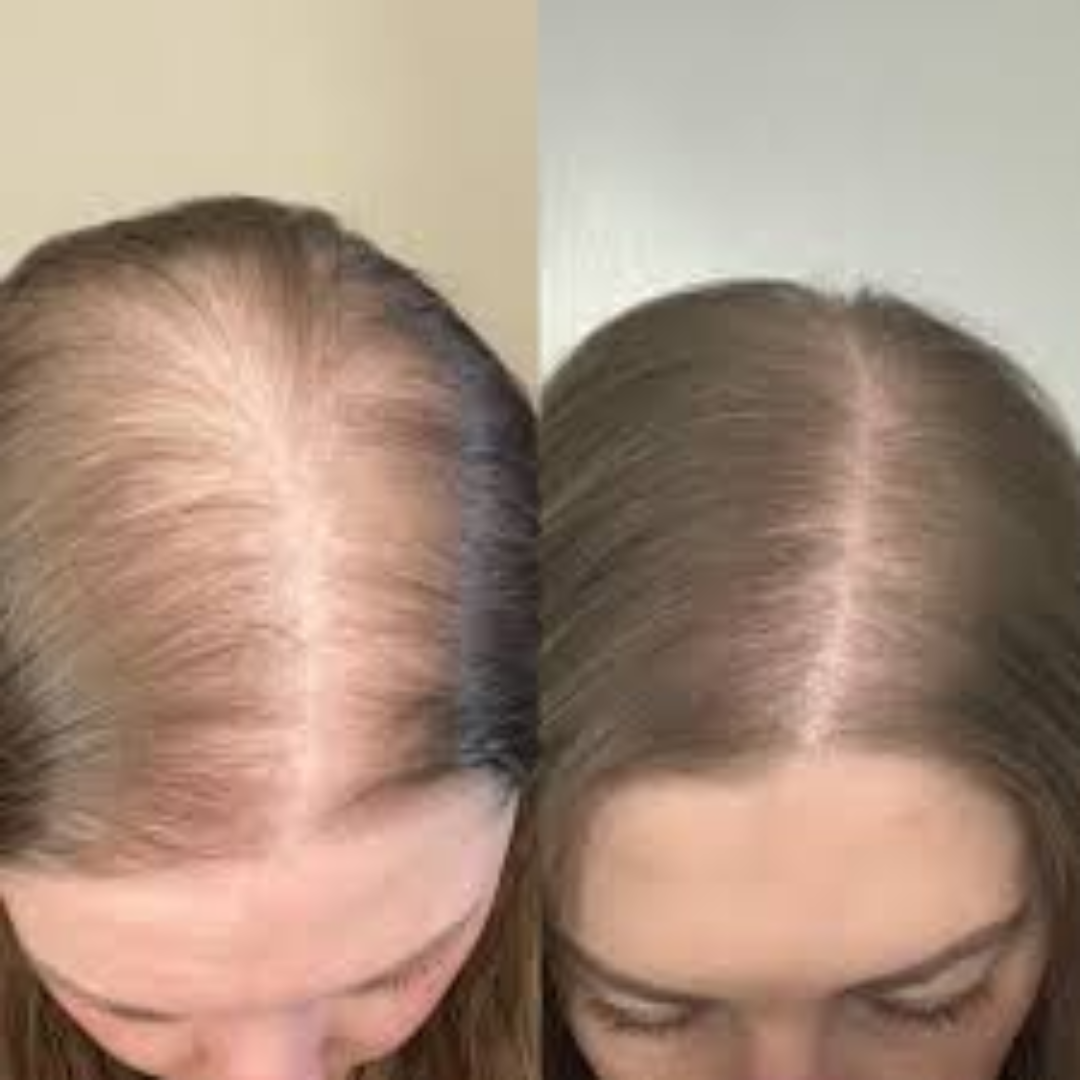 The Muse Labs Peptide Hair Growth Serum | Multi-Peptide Complex with Copper Peptides | Boosts Hair Growth, Reduces Hair Fall & Strengthens Roots