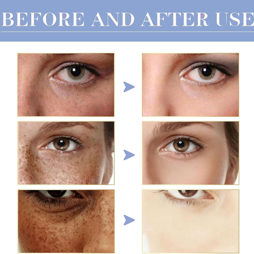 Dark Spot Corrector for Face – Fade Dark Spots Fast – Bright, Even Skin – Targets Sun Spots, Age Spots, Acne Marks & Freckle