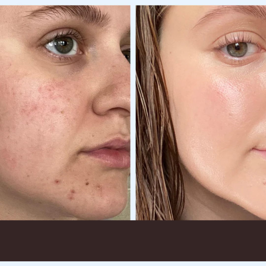 Celimax Noni Ampoule Calming + Radiance | Soothing Hydrating Serum for Healthy, Glowing Skin