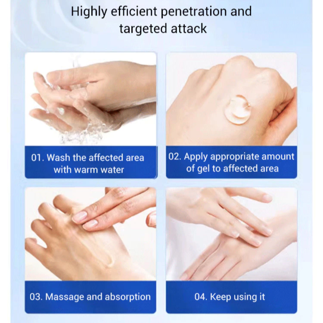 Acne & Acne Scars Removal Cream – Fast Acne Treatment, Fades Scars, Controls Oil & Bacteria – Suitable for Face, Back & Neck