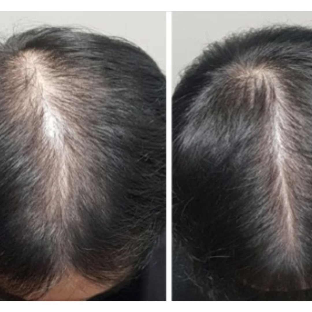 The Muse Labs Peptide Hair Growth Serum | Multi-Peptide Complex with Copper Peptides | Boosts Hair Growth, Reduces Hair Fall & Strengthens Roots