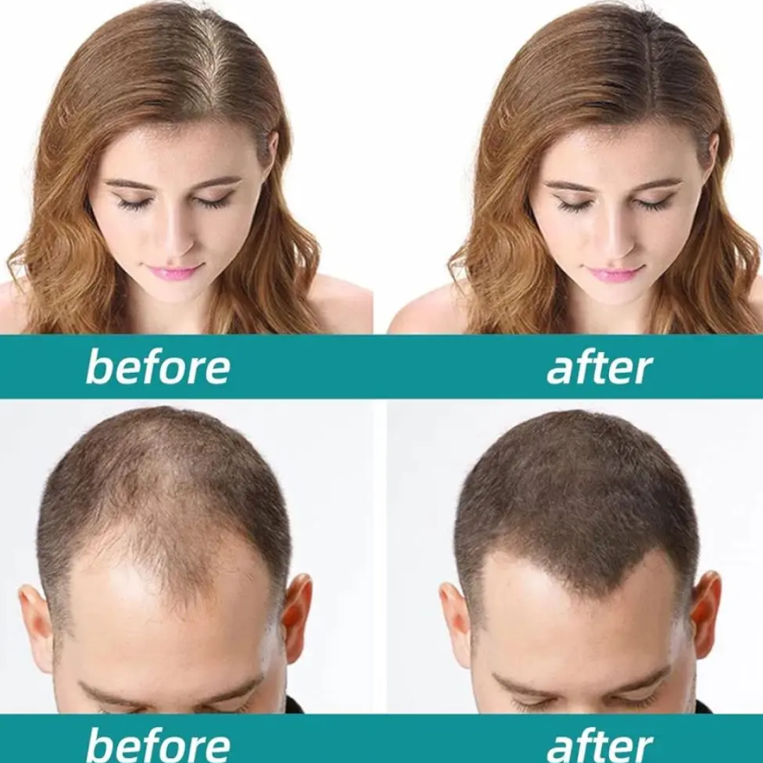 The Muse Labs Peptide Hair Growth Serum | Reduces Hair Fall, Boosts Density & Strengthens Roots | Multi-Peptide Formula