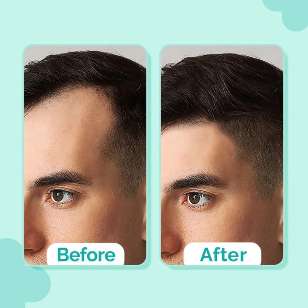 The Muse Labs Peptide Hair Growth Serum | Reduces Hair Fall, Boosts Density & Strengthens Roots | Multi-Peptide Formula