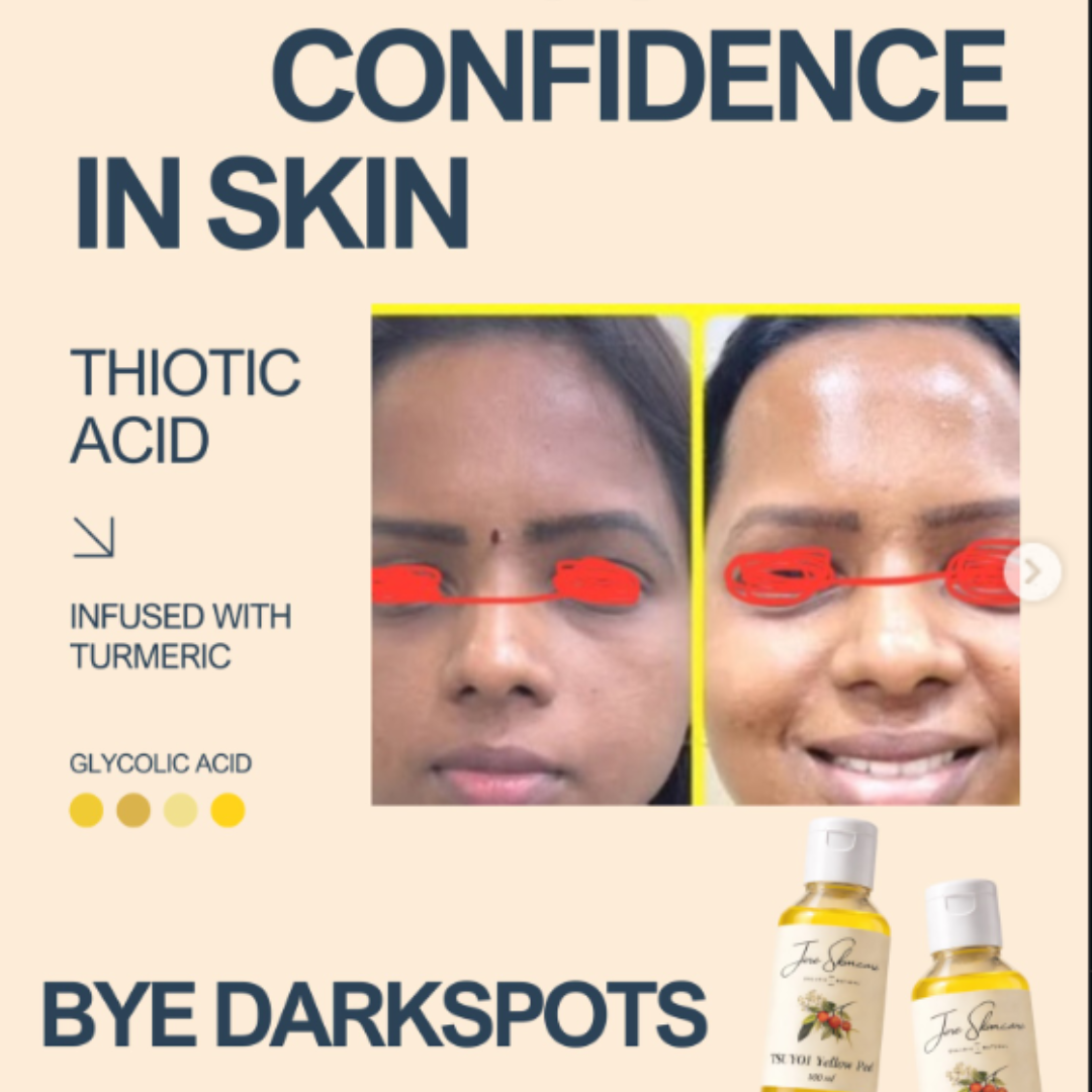 Jiore Tsuyoi Yellow Peel Body Oil | Organic & Natural with Kojic Acid, Turmeric, Thiotic Acid & AHA/BHA | Fades Stretch Marks, Peels Sun Tan & Brightens Skin