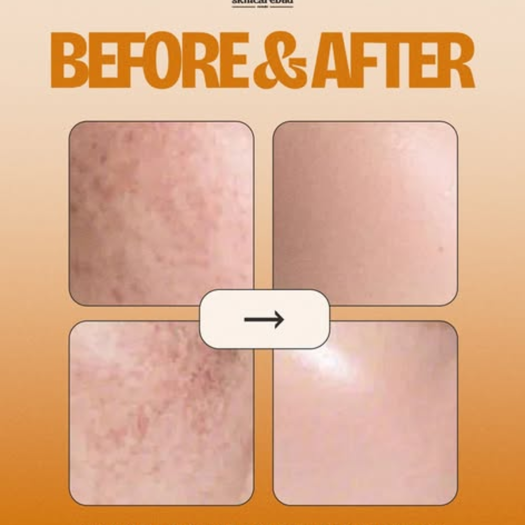 Reju-all PDRN Cream - Remove dark spots, blemishes, dry - patches & give glowing smooth & hydrated skin