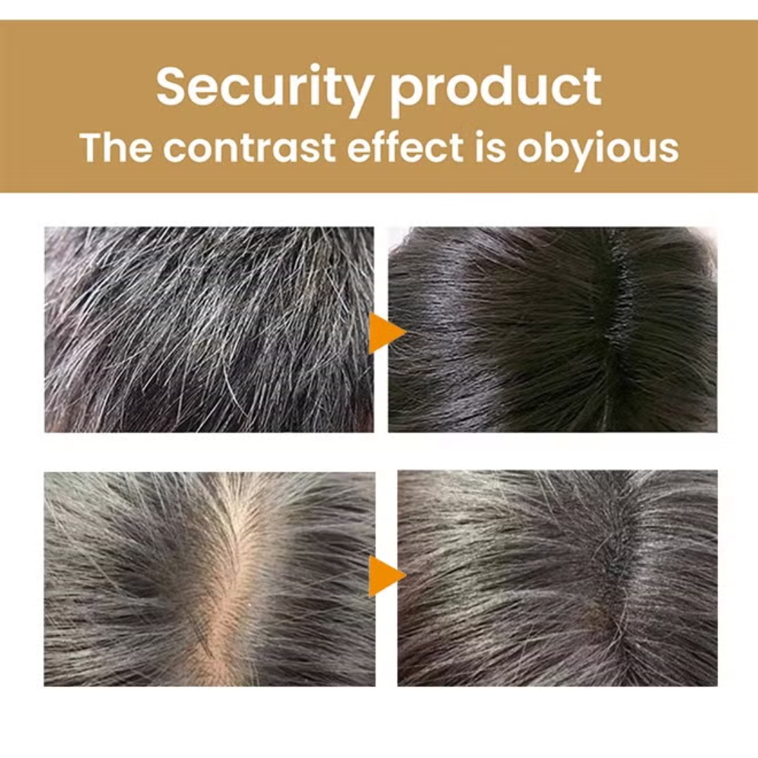 SL Basics Ginger Hair Care Duo: Anti-Hair Fall Shampoo + Nourishing Hair Oil - Promotes Growth & Fights Dandruff