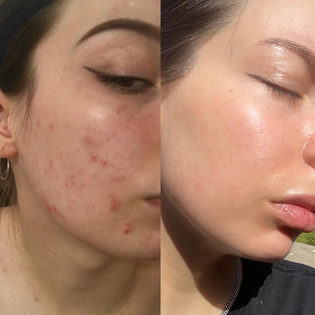 Celimax Noni Ampoule Calming + Radiance | Soothing Hydrating Serum for Healthy, Glowing Skin