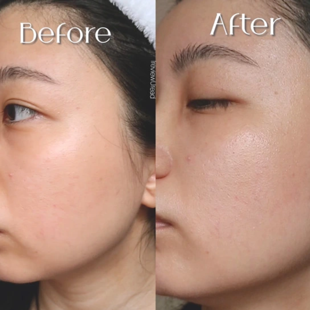 Beauty of Joseon Relief Sun Aqua-Fresh Rice + B5 Sunscreen | SPF50+ PA++++ Lightweight, Cooling & Hydrating UV Protection | No White Cast, Fast Absorption