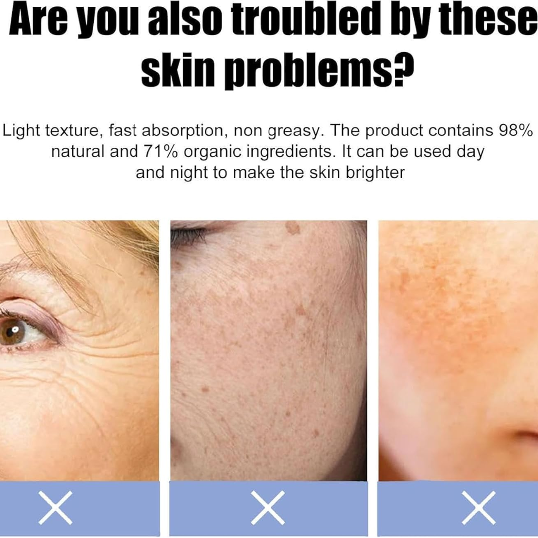 Dark Spot Corrector for Face – Fade Dark Spots Fast – Bright, Even Skin – Targets Sun Spots, Age Spots, Acne Marks & Freckle