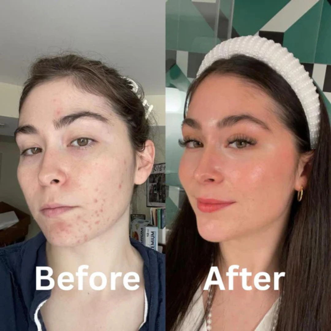 Medicube Collagen Night Wrapping Mask – 50% OFF – Wake Up to Glass Skin – Overnight Care – Boosts Collagen, Deep Hydration & Glass Skin Glow – Strengthens Skin Barrier – For All Skin Types