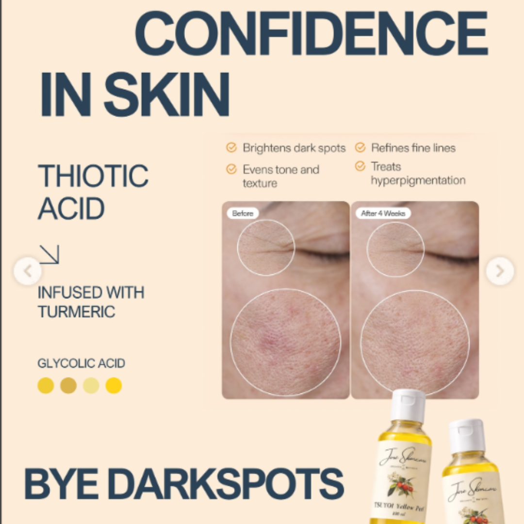 Jiore Tsuyoi Yellow Peel Body Oil | Organic & Natural with Kojic Acid, Turmeric, Thiotic Acid & AHA/BHA | Fades Stretch Marks, Peels Sun Tan & Brightens Skin