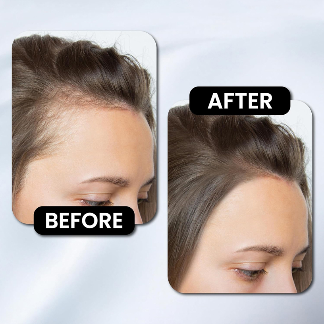 The Muse Labs Peptide Hair Growth Serum | Reduces Hair Fall, Boosts Density & Strengthens Roots | Multi-Peptide Formula