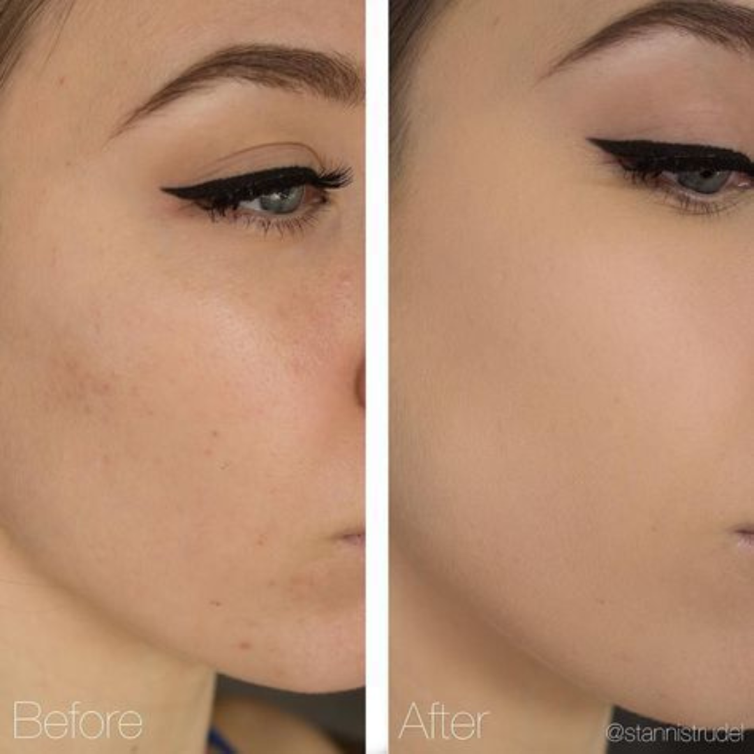 STAZE Glowing Foundation + Brightening compact Powder | 12-hours longwear, Oil control & Flawless filter like finish