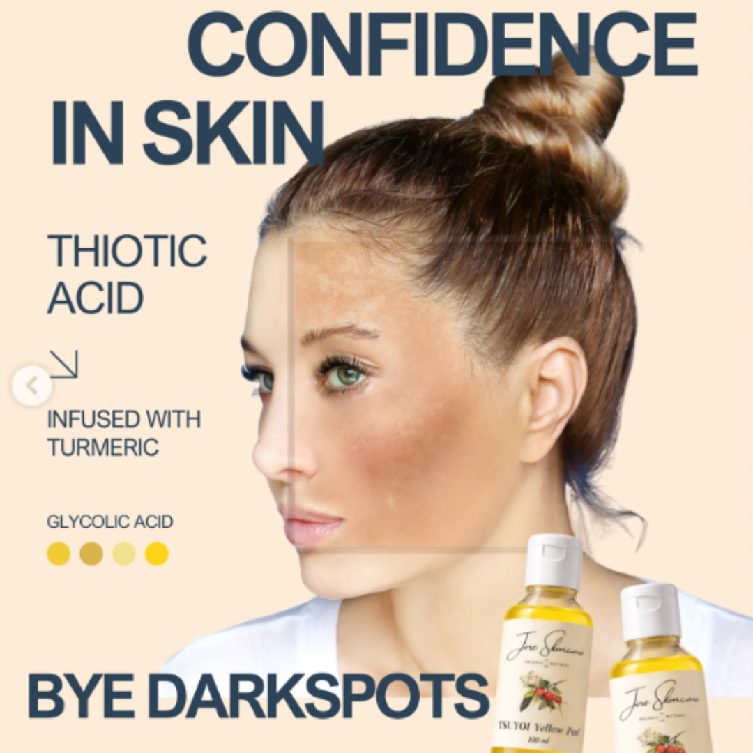 Jiore Tsuyoi Yellow Peel Body Oil | Organic & Natural with Kojic Acid, Turmeric, Thiotic Acid & AHA/BHA | Fades Stretch Marks, Peels Sun Tan & Brightens Skin
