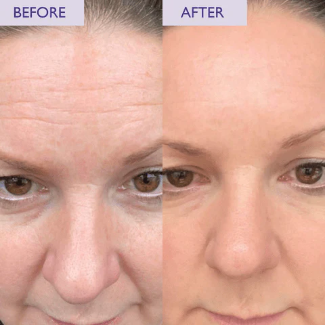 May & Marry Retinol & Collagen (Day & Night) Cream | collagen for day & Retinol for Night | Reduce Wrinkles & Smile Lines, minimizing pores & improve skin texture