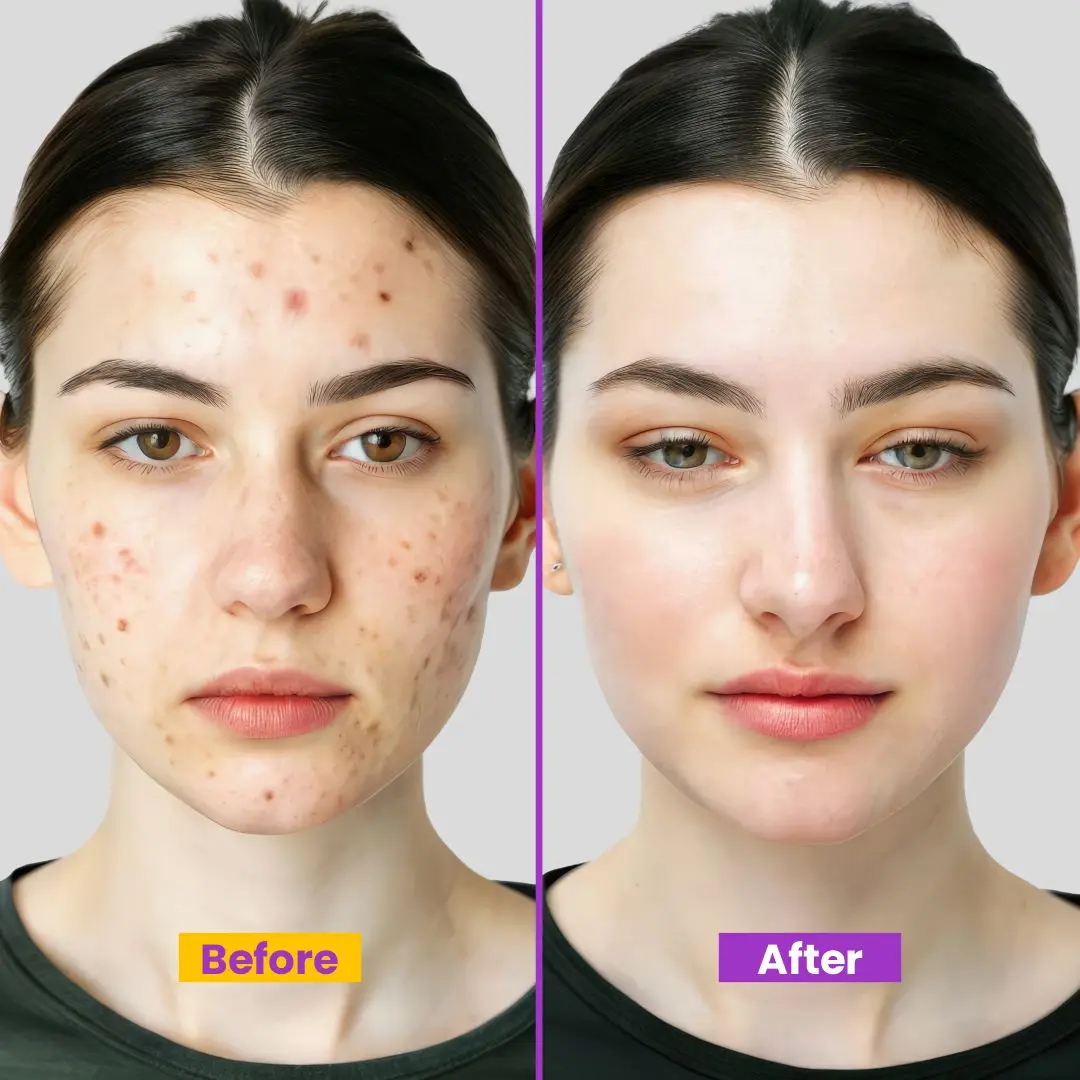 Dark Spot Corrector for Face – Fade Dark Spots Fast – Bright, Even Skin – Targets Sun Spots, Age Spots, Acne Marks & Freckle