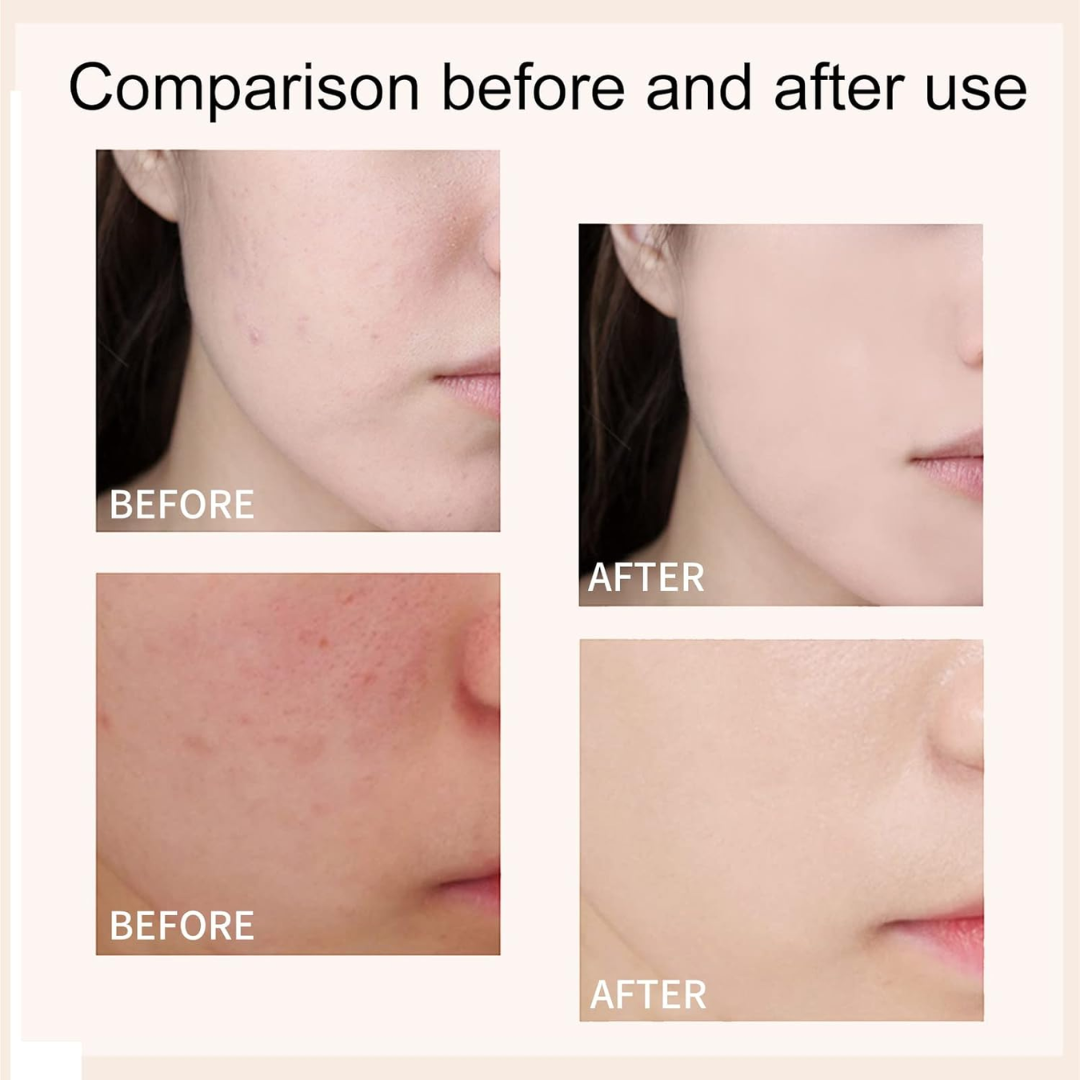 Anua Crystal Glow Duo: Rice Enzyme Brightening Cleansing Powder & PDRN Collagen Capsule Mist | Deep Hydration + Glass Skin Set