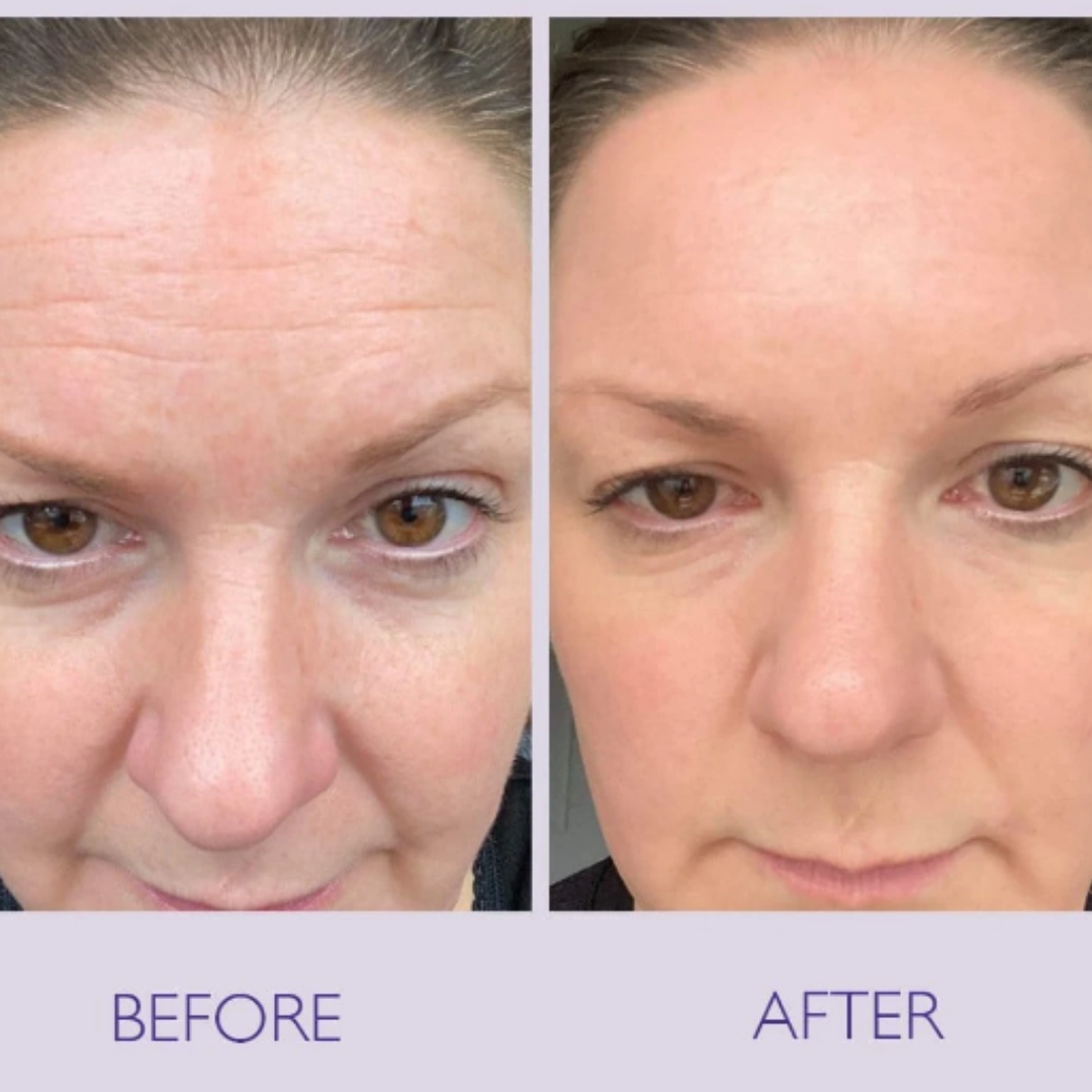 May & Marry Retinol & Collagen (Day & Night) Cream | collagen for day & Retinol for Night | Reduce Wrinkles & Smile Lines, minimizing pores & improve skin texture