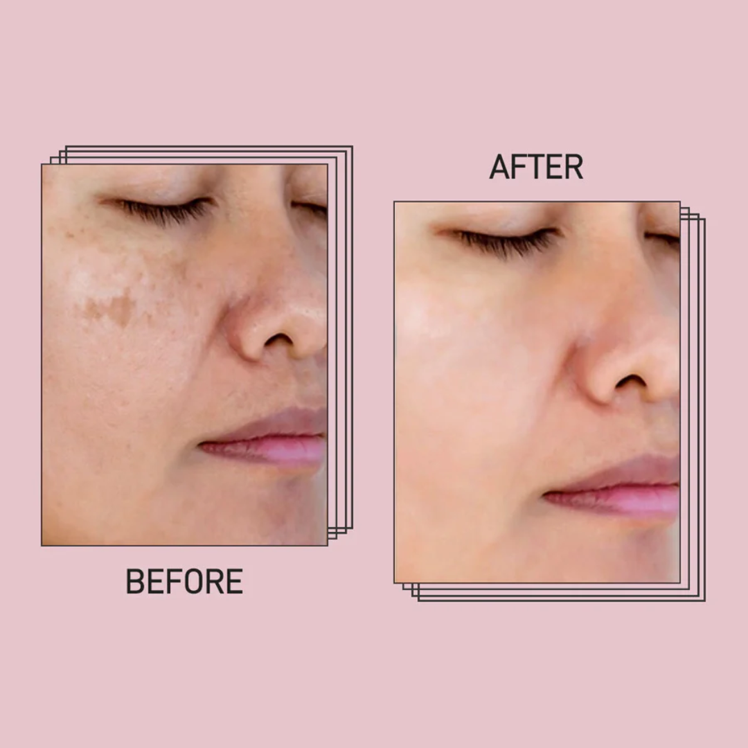 Anua PDRN + Hyaluronic Acid 100 Moisturizing Cream – Deep Hydration & Skin Plumping Cream for Glass Skin