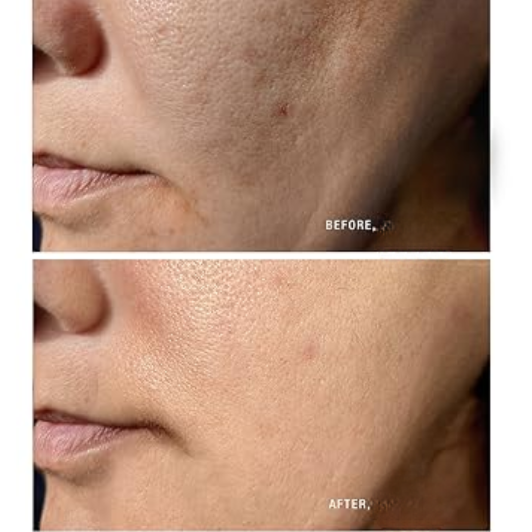 2-in-1 Rice  mask & cleanser (Remove black & white heads , tightening pores and give instant clean & bright skin tone)