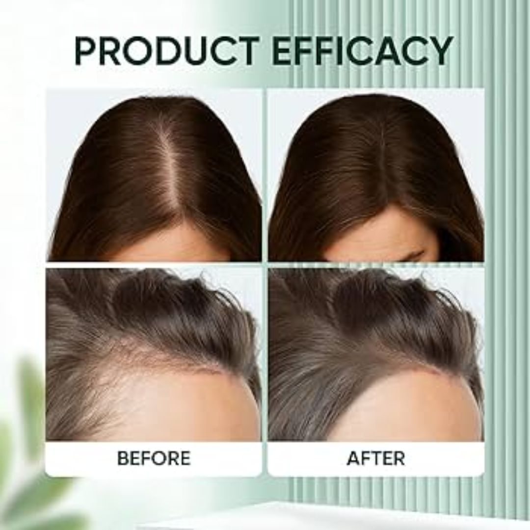 The Muse Labs Peptide Hair Growth Serum | Reduces Hair Fall, Boosts Density & Strengthens Roots | Multi-Peptide Formula