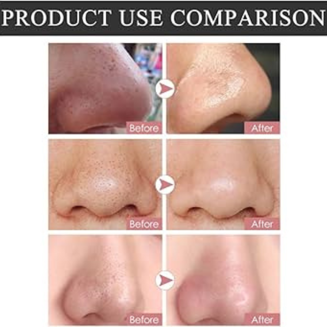SKINTIFIC Alaska Volcano Pore Clay Stick | Glycolic Acid + Probiotic Complex + Collagen | Removes Blackheads, Tightens Pores & Smooths Skin