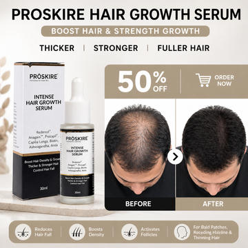 Proskire Hair Growth Serum – Reduces Hair Fall, Boosts Hair Density, Activates Follicles – For Bald Patches, Receding Hairline & Thinning Hair