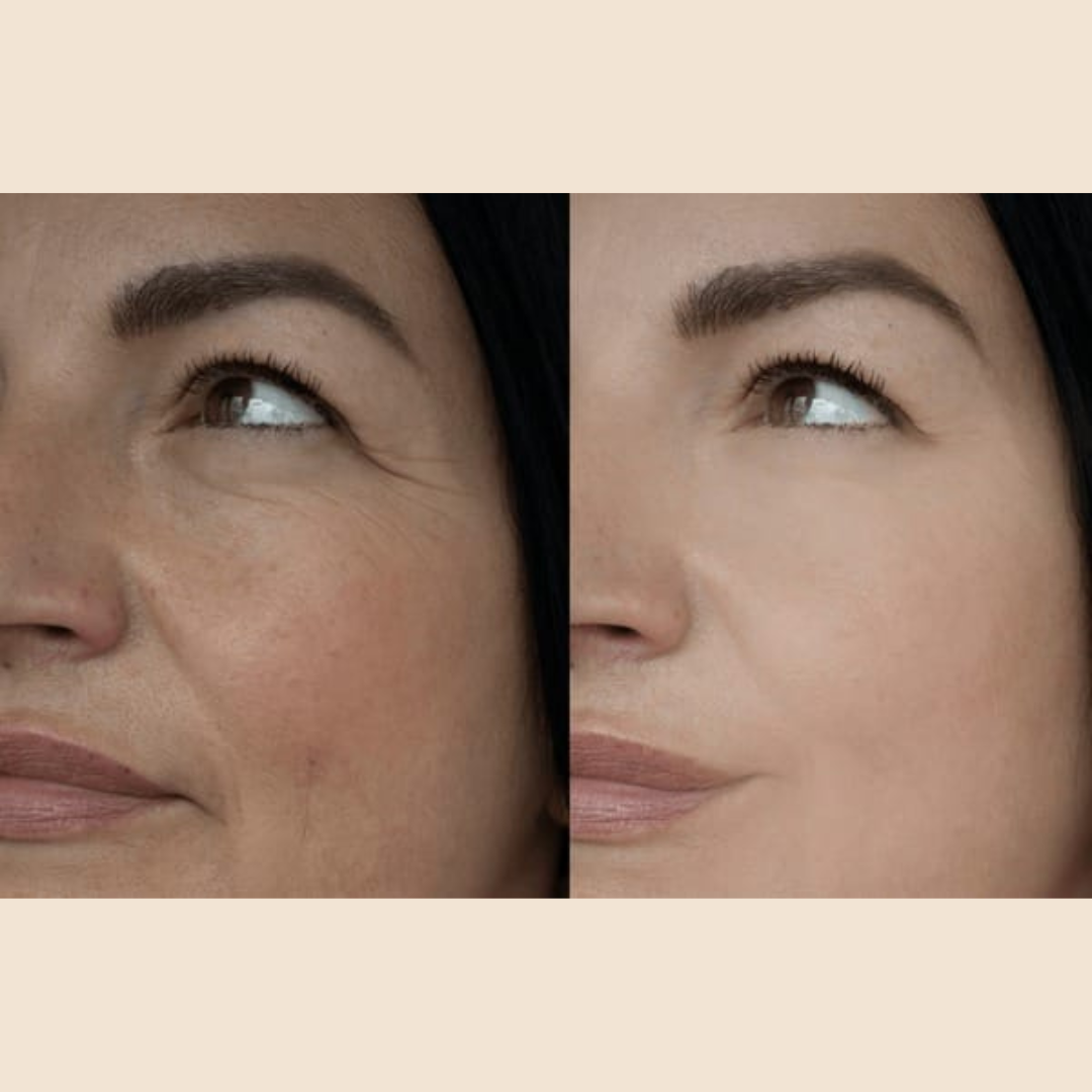 Reju-all PDRN Cream - Remove dark spots, blemishes, dry - patches & give glowing smooth & hydrated skin