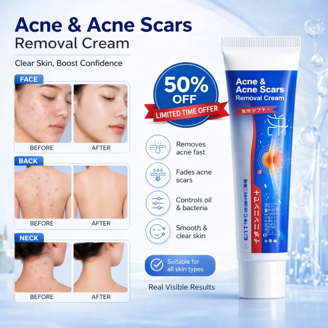 Acne & Acne Scars Removal Cream – Fast Acne Treatment, Fades Scars, Controls Oil & Bacteria – Suitable for Face, Back & Neck