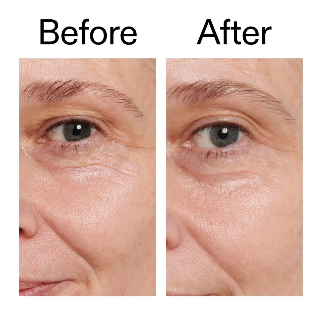 May & Marry Retinol & Collagen (Day & Night) Cream | collagen for day & Retinol for Night | Reduce Wrinkles & Smile Lines, minimizing pores & improve skin texture