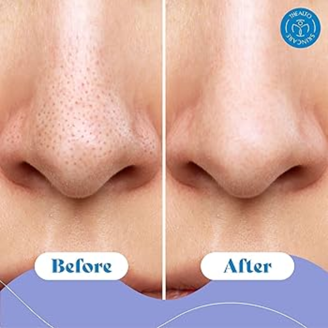 Dr. Melaxin Peel Shot PS Exfoliating Black Rice Ampoule | Removes Blackheads, Tightens Pores & Smooths Skin