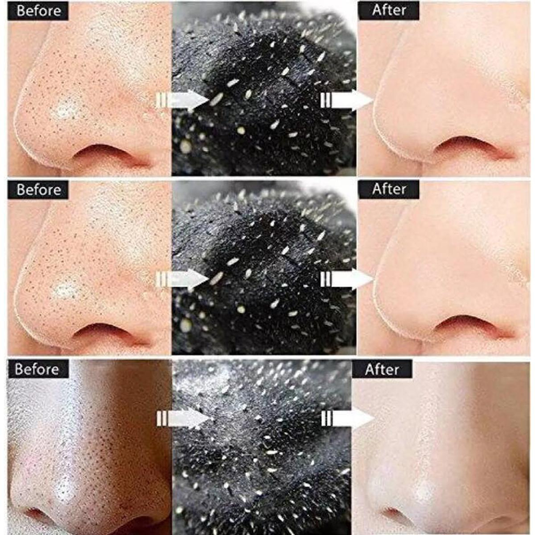 SKINTIFIC Alaska Volcano Pore Clay Stick | Glycolic Acid + Probiotic Complex + Collagen | Removes Blackheads, Tightens Pores & Smooths Skin