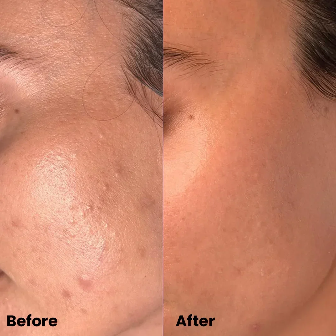 AXIS-Y Triple PDRN Gel Toner | 6+1+1 Advanced Formula with Plant-Based PDRN, Astaxanthin & Vegan Collagen | Strengthens Barrier, Hydrates & Calms Skin