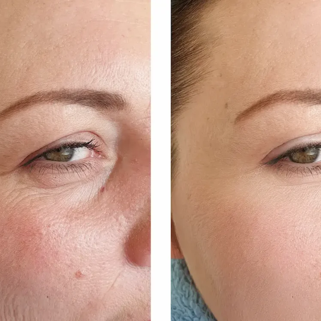 May & Marry Retinol & Collagen (Day & Night) Cream | collagen for day & Retinol for Night | Reduce Wrinkles & Smile Lines, minimizing pores & improve skin texture