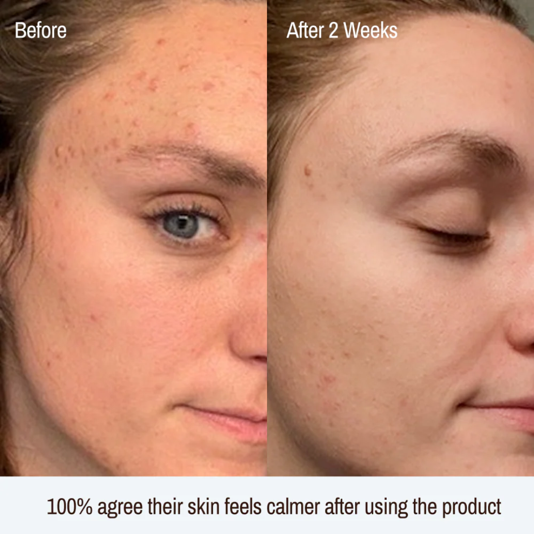 AXIS-Y Triple PDRN Gel Toner | 6+1+1 Advanced Formula with Plant-Based PDRN, Astaxanthin & Vegan Collagen | Strengthens Barrier, Hydrates & Calms Skin