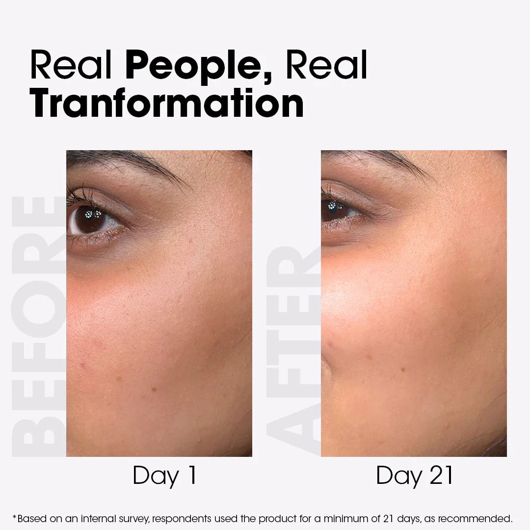 Anua PDRN + Hyaluronic Acid 100 Moisturizing Cream – Deep Hydration & Skin Plumping Cream for Glass Skin