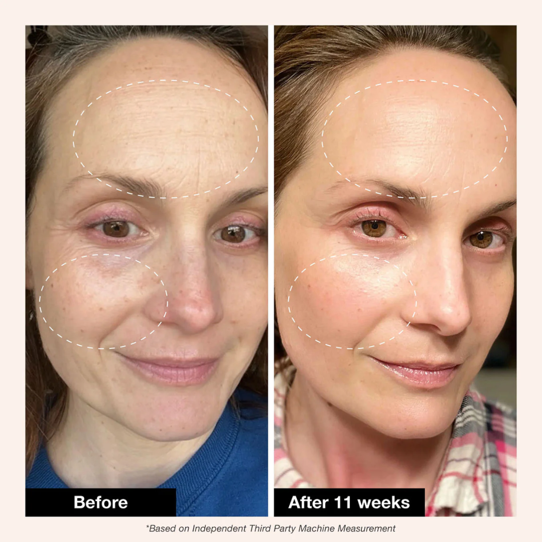 May & Marry Retinol & Collagen (Day & Night) Cream | collagen for day & Retinol for Night | Reduce Wrinkles & Smile Lines, minimizing pores & improve skin texture