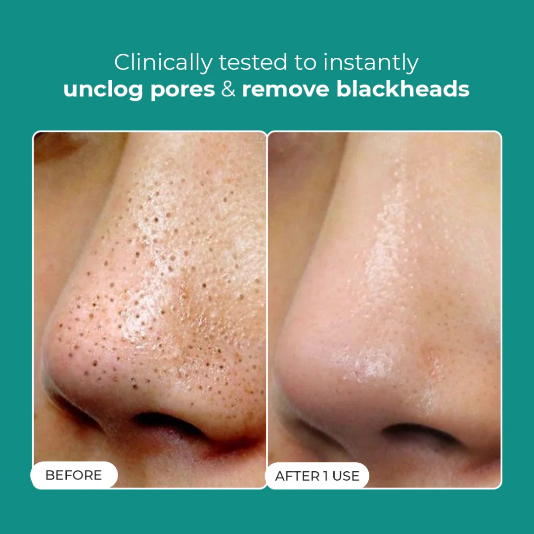 Dr. Melaxin Peel Shot PS Exfoliating Black Rice Ampoule | Removes Blackheads, Tightens Pores & Smooths Skin