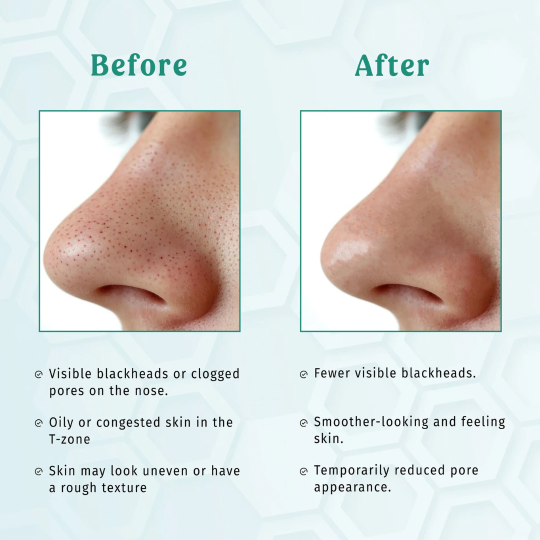 SKINTIFIC Alaska Volcano Pore Clay Stick | Glycolic Acid + Probiotic Complex + Collagen | Removes Blackheads, Tightens Pores & Smooths Skin